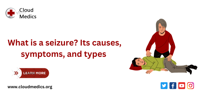 What is a seizure